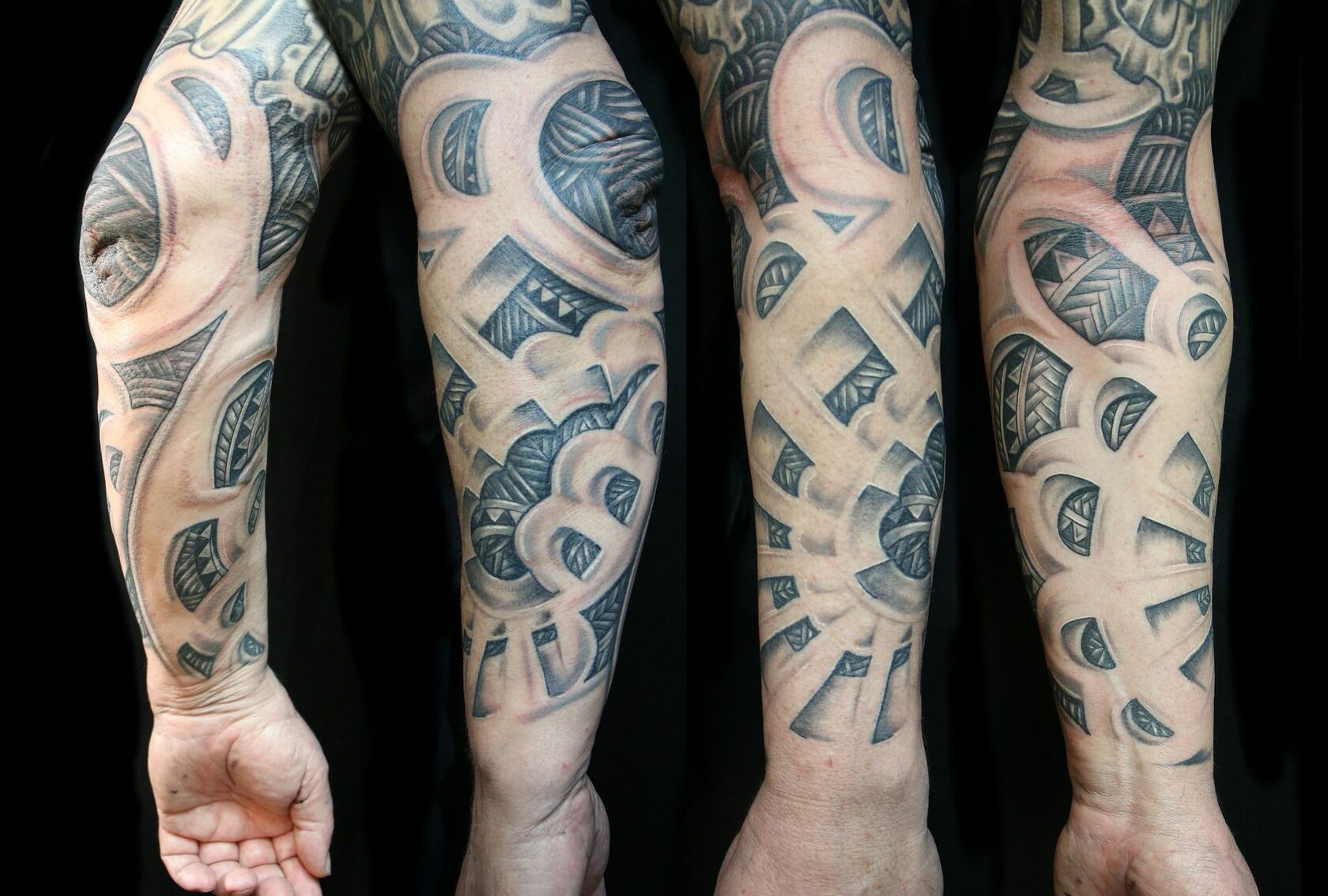 Удаление татуировок в Махачкале